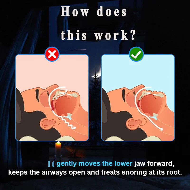 Lightweight, Comfortable, and Effective for Reducing Snoring- Anti-Snoring Guard