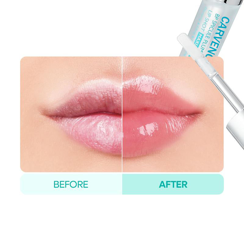 Liquid Microneedling Lip Gloss – Plumping Treatment for Glassy, Voluminous Lips, 4ml