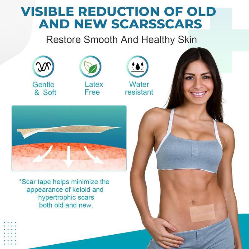 Reusable Scar Tape – Silicone Strips for Keloids, Burns & Acne, Safe for All Skin Types